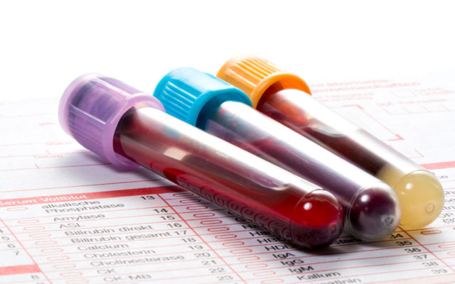 A New Study Was Able to Find Cancer Just by Doing a Simple Blood Test